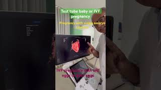 IVF pregnancy [upl. by Ylac]