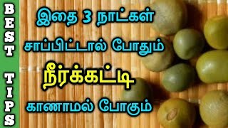 PCOD problem solution in Tamil  Home Remedy  Best Tips  complete cure [upl. by Neyu]