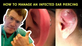 How to recognise manage and treat an infected ear piercing  Doctor ODonovan explains [upl. by Carlisle206]