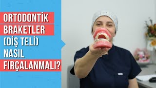 Ortodontik Braketler Diş Teli varken nasıl diş fırçalanır [upl. by Onileva]