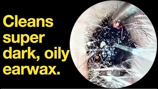 Cleans super dark oily earwax ear wax removal  ear cleaning  ASMR  relaxation  relax [upl. by Debera]