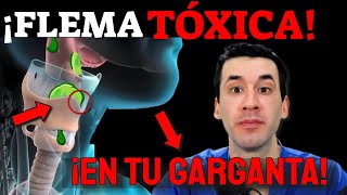 FLEMA TÓXICA en TU GARGANTA ¡ELIMÍNALA INMEDIATAMENTE [upl. by Esiole]