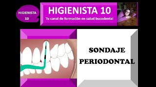 SONDAJE PERIODONTAL TEMARIO GENERAL 25 [upl. by Thurlough]