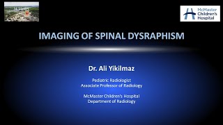 Spinal Dysraphism [upl. by Francoise192]