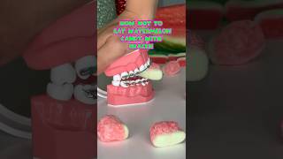 How NOT to eat WATERMELON CANDY with BRACES what to eat instead braces watermelon candy [upl. by Sabba]