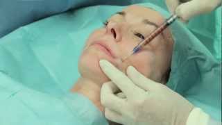 Strim  Facial autologous fat micro grafting [upl. by Colbye]