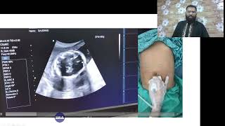 Lecture 1  Fetal Ultrasound Technique of Fetal USG in Second and Third Trimester  Iqramed Academy [upl. by Ylurt]