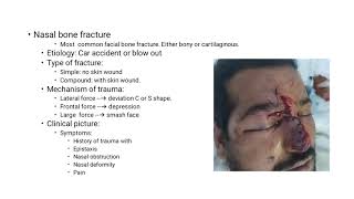 Choanal Atresia Oroantral Festula CSF Rhinorrhea Septal Hematoma Septal Abscess د ناصر العزيب [upl. by Eliades2]