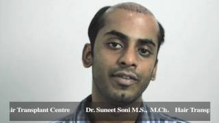 Hair Transplant in Hindi  FUT or FUE  With Dr Suneet Soni at Medispa Jaipur and Delhi India [upl. by Tolliver]