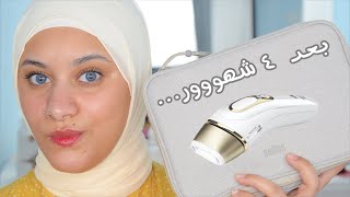 نتيجة ازالة شعر الجسم بالليزر ف البيت بعد ٤ شهور  braun ipl silk expert pro 5  after 4 months [upl. by Ysle121]