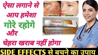 Melamet cream के साइड इफेक्ट्स कैसे ठीक करें  melamet cream kaise use kare ताकि नुकसान ना हो [upl. by Ronald]