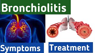 Bronchiolitis breathing  bronchiolitis cough symptoms causes diagnosis and treatment bronchitis [upl. by Anekahs]