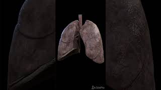 What a smokers lung looks like anatomy meded [upl. by Nanoc]