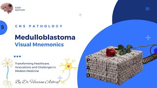 Medulloblastoma Pathology  Visual Mnemonics  Morphology  CNS Pathology  NEET PG USMLE MBBS [upl. by Mcarthur]