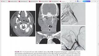 EMERGENCY RADIOLOGY REQUISITES [upl. by Martell]