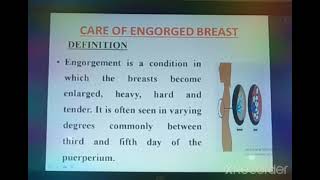 Procedure for Care of engorged Breast [upl. by Dyal852]