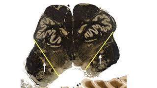 LTB Learning the Brainstem video 15 At the level of CN twelve nucleus [upl. by Antonetta109]