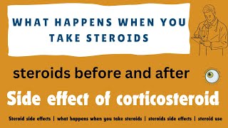 Steroid side effects  what happens when you take steroids  steroids side effects  steroid use [upl. by Affer]