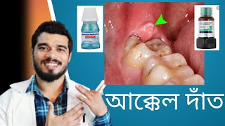 আক্কেল দাঁত নিয়ে সকল সমস্যার সমাধান  How to prevent Wisdom Teeth problem [upl. by Nyledam]