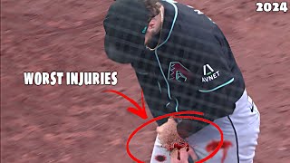 MLB• Worst Injuries Of June•2024 [upl. by Mctyre]