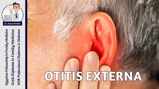 Otitis Externa [upl. by Morty]