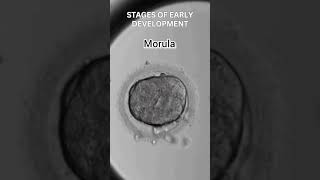 Early development of human  Cleavage  morula  blastulation [upl. by Dena555]