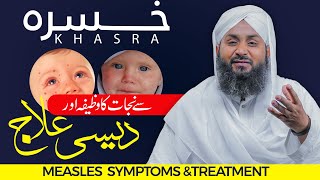 Khasra Ki Bimari Ka Khas Wazifa  Measles Symptoms amp Treatment  Khasra خسرہ Ka Desi Ilaj [upl. by Stinson]