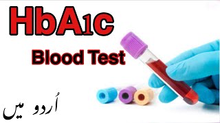 HbA1c Blood Test In Urdu  HbA1c Test for Diabetes  Hemoglobin A1c Test Normal LowHigh Levels [upl. by Uyr]