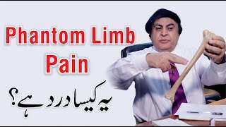 Phantom limb pain treatment in UrduHindi  Pain Ka Ilaj  By Dr Khalid Jamil [upl. by Laughry]