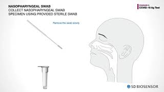 Video Guide for STANDARD Q COVID 19 Ag test [upl. by Lalaj]