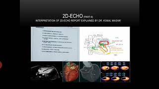 Basics of 2D Echo Part 8in Hindi  How to read and understand 2D Echo report [upl. by Ehgit]