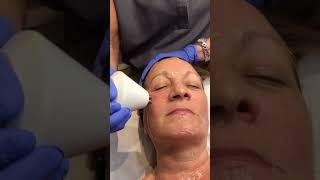 New to the clinic is the Radio Frequency skin tightening facial treatment from Pollogen [upl. by Latham]