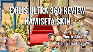 NON INVASIVE TREATMENT REVIEW Exilis Ultra 360 Experience at Kamiseta Skin BGC 2023 [upl. by Einaffets340]