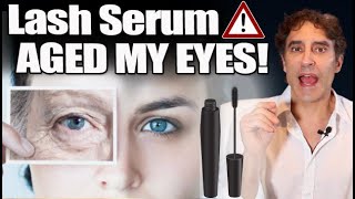 LASH SERUM⚠️WARNING⚠️ EXPOSED for AGING YOUR EYES  Lash Conditioner may Be Aging Your Eyes [upl. by Otxis487]