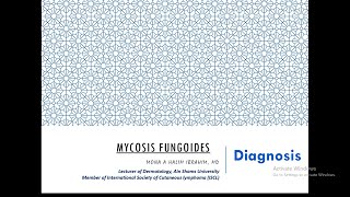 2 Diagnosis of Mycosis Fungoides [upl. by April]