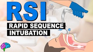 What is Rapid Sequence Intubation RSI [upl. by Joye]