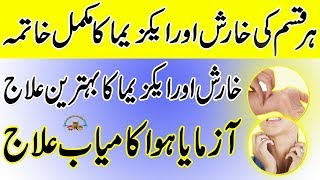 Kharish Ka Ilaj  Kharish Ka Desi Ilaj In Urdu  Eczema Ka Ilaj  Health Tips In Urdu [upl. by Ybbor]