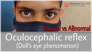 Doll’sEyeReflex Vestibulo Ocular reflex Normal amp ABnormal MADEEASY medicine neurology [upl. by Vanhook]