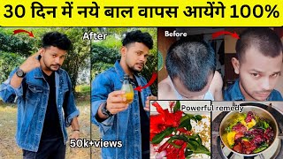 30 दिन में Hair Regrowth ampThin To Thick Hair Challenge 100  Results Hair Growth Tips Dhru Rao [upl. by Aicinoid96]