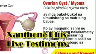 Ovarian Cyst MyomaXANTHONE PLUS Live Testimony [upl. by Arocat839]