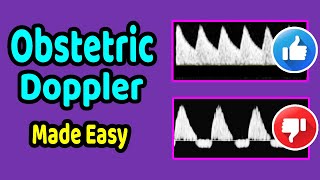 Obstetric Doppler Made Easy [upl. by Anerat]