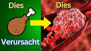 Dfährliche Blutgerinnsel  7 Lebensmittel die du meiden solltest Schütze dein Herz mit diesen Tipps [upl. by Korns]