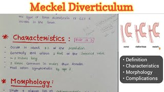 Meckel Diverticulum  GIT Pathology [upl. by Aerdnaxela]