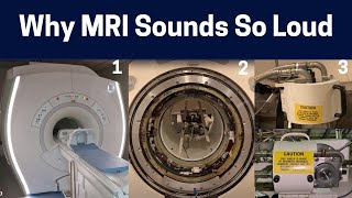 What Makes The Different MRI Scan Sounds Knocking to Rhythmic Chirping MRI Sounds Explained [upl. by Hembree900]