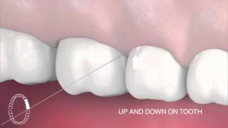 How to use interdental floss [upl. by Pallaten]