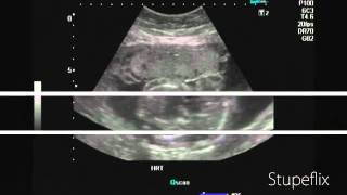 The Cardiac Cycle  Systole and Diastole  Atria and Ventricles  Physiology and Biology [upl. by Dehsar]