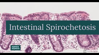 Intestinal Spirochetosis [upl. by Niahs]