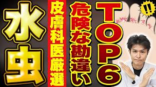 水虫これダメ絶対６選！注意したい水虫の治療や原因と対策法、薬についての解説 [upl. by Xever333]