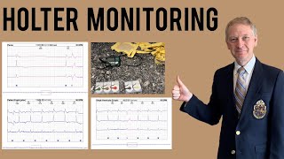 Holter Monitor  Everything you need to know [upl. by Hulton]