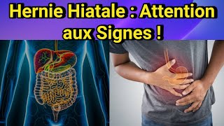 Hernie Hiatale  Symptômes Types et Traitements – Comprendre cette pathologie fréquente [upl. by Salesin]